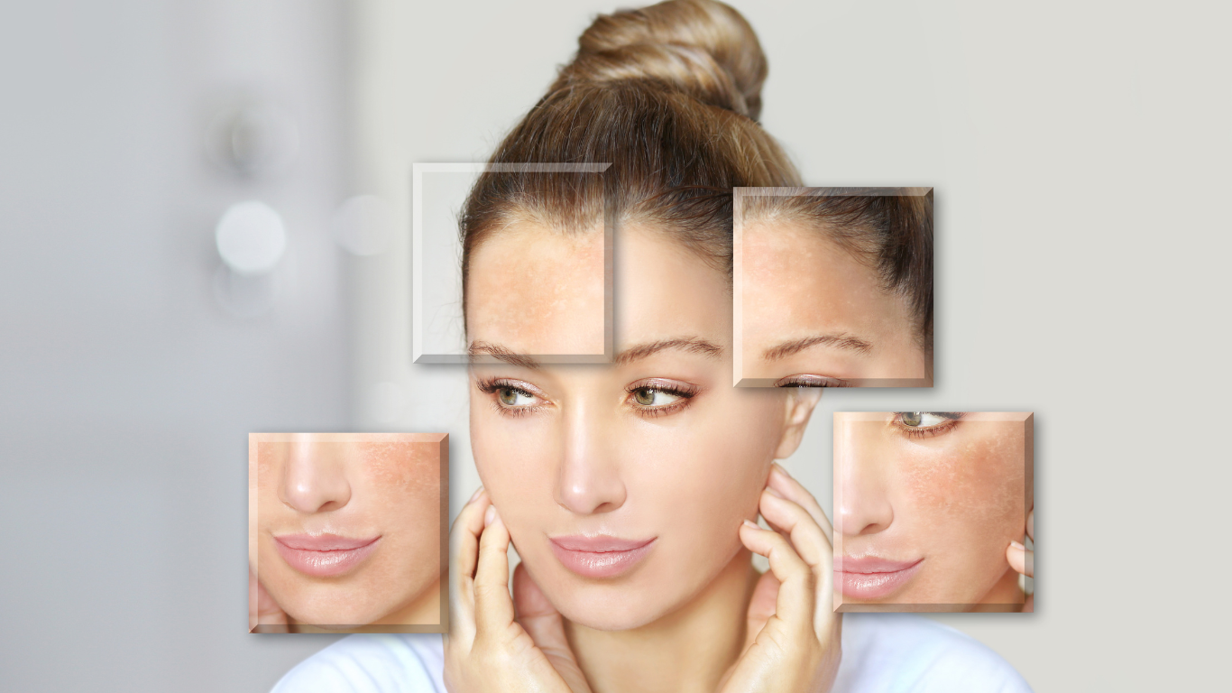 Hyaluronic Acid (HA) benefits on different skin types and skin problems.